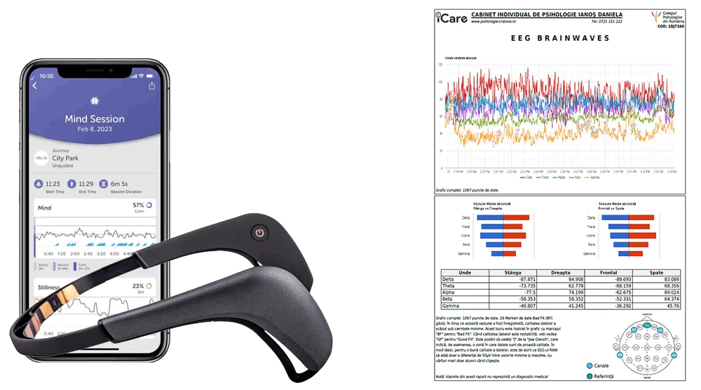 Monitorizare cerebrală și neurofeedback Craiova - Psiholog Daniela Ianoș